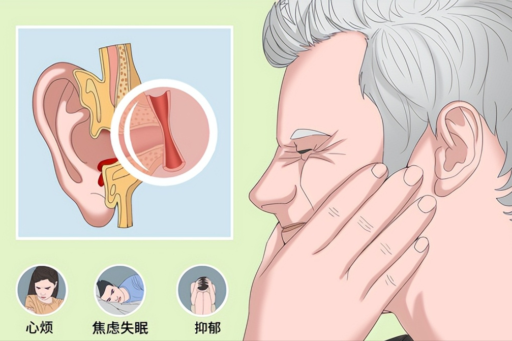 有耳鸣不要怕，用这三个方法，强效止鸣